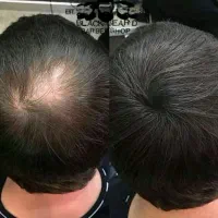 این فقط یک عکس قبل و بعد نیست...