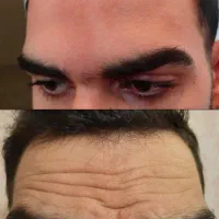 آف یلدایی ژل و بوتاکس|خدمات آرایشگری و زیبایی|دورود, |دیوار