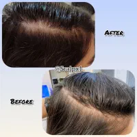 درمان تمام مشکلات مو