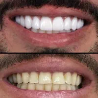 دندانپزشکی  صدف با (آفر های ویژه )
