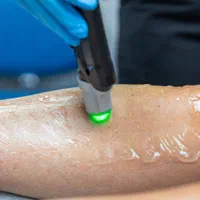 دستگاه لیزر مو 2024 با 3طول موج