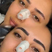 کاور و روشن سازی تاتوهای قدیمی و تیره بدونه ریمو