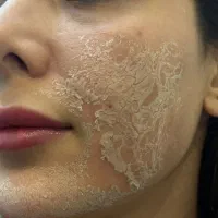 اولین اتاق پوست صومعه سرا با تراپی های درمانی|خدمات آرایشگری و زیبایی|صومعه‌سرا, |دیوار