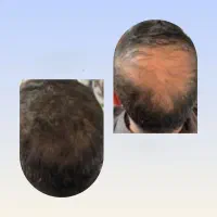 دوباره رشد می‌کنه
