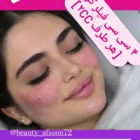 تخفیف استثنایی خدمات ژل فیلر بوتاکس|خدمات آرایشگری و زیبایی|کرج, گلشهر|دیوار