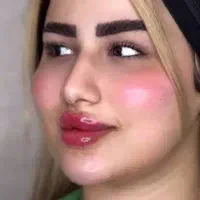 تخفیف ویژه ژل و بوتاکس