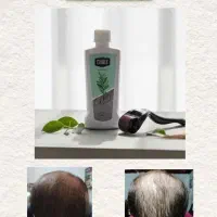 تونیک هیر فرند|مواد شوینده و دستمال کاغذی|مرند, |دیوار