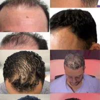 به موهات یه شانس د‌وباره بده