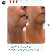 کرم بیوممتیک لاکچری کویین