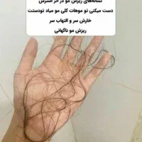 دیگه با ریزش موهات خداحافظی کن|آرایشی، بهداشتی، درمانی|کرج, عظیمیه|دیوار