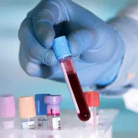 خدمات پرستاری در منزل / تزریقات|خدمات آرایشگری و زیبایی|اسلامشهر, شهرک واوان|دیوار