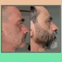 به فکر کم پشنی ریش و موهات باش