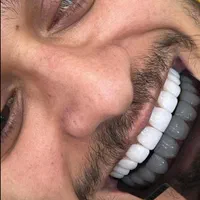 جشنواره خدمات زیبایی دندان با افر 60٪ از دست ندید|خدمات آرایشگری و زیبایی|بابل, |دیوار