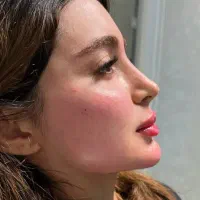 فیلر فول بادی