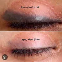 اجرا و حذف تتو|خدمات آرایشگری و زیبایی|شیراز, مسلم|دیوار