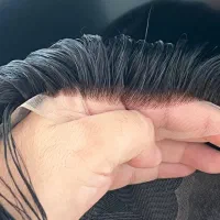 خدمات تخصصی پروتزمو سبزوار