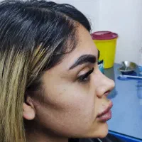 لیفت صورت|خدمات آرایشگری و زیبایی|تهران, شیخ هادی|دیوار