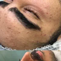 فیشال وپاکسازی پوست|خدمات آرایشگری و زیبایی|تهران, دردشت|دیوار