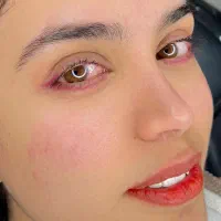 میکروبلیدینگ تخصصی ابرو