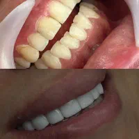 بزرگ ترین تخفیف پاییزه دندانپزشکی|خدمات آرایشگری و زیبایی|شیراز, خلدبرین|دیوار