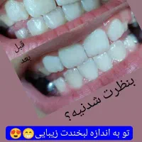 راهنمایی درباره محصول سفید کننده دندان|فعالیت داوطلبانه|مشهد, شهرک بهارستان|دیوار