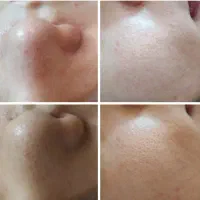 فشیال تخصصی واسه بانوان عزیز|خدمات آرایشگری و زیبایی|مشهد, فدک|دیوار