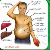 پاکسازی و اصولی کبد