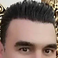 کاشت مو ابرو به بروز ترین با شرایط پرداخت اقساطی