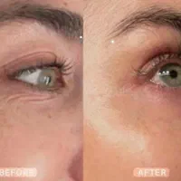 فروش حلزون آلبینو مخصوص حلزون‌تراپی|خزنده|قروه, |دیوار