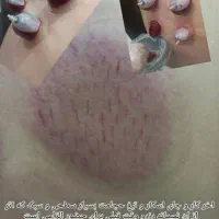 کار طب سنتی با آموزش ودرآمد در منزل|استخدام درمانی، زیبایی، بهداشتی|قرچک, زیبا شهر|دیوار