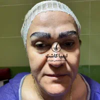 مدل کاشت ابرو|خدمات آرایشگری و زیبایی|گرگان, |دیوار