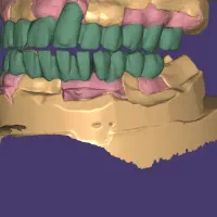 استخدام نیرو دندانسازی