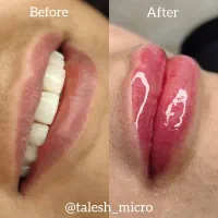 جشنواره ویژه میکرو و شیدینگ لب