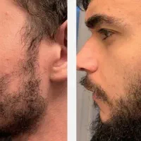 این اقدام آخریشه