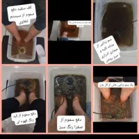 سم زدایی بدن با دستگاه وماساژدرمانی