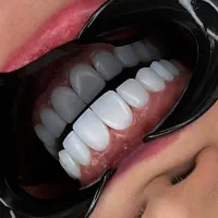 کامپوزیت دندان فقط ۳ تومن