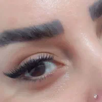 کاشت هیدن
