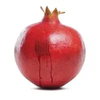 حجامت