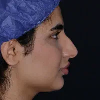 جراحی بینی پزشک متخصص 55 ملیون