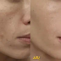 کرم ضدلک لاکچری کوین|آرایشی، بهداشتی، درمانی|هشتگرد, شهرک راه آهن|دیوار