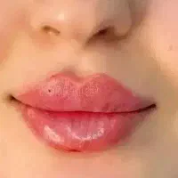 تزریق ژل|خدمات آرایشگری و زیبایی|بندر گناوه, |دیوار