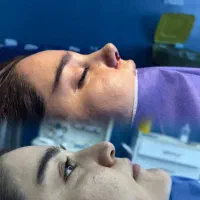 جشنواره بوتاکس