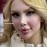 فیلربادی۱۵۰مزو،بوتاکس،انزیم.فول فیس،فیلر۵۵۰