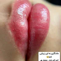 خدمات شیدینگ لب|خدمات آرایشگری و زیبایی|تهران, پرستار|دیوار