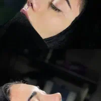 عمل بینی بدون تامپون با اقساط ۲ ساله