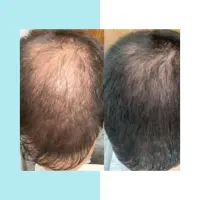 یک قدم تا تغییر اساسی