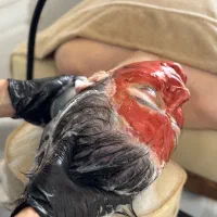 پاکسازی پوست فیشال  و اسکالپ سردر کلینیک زیبایی