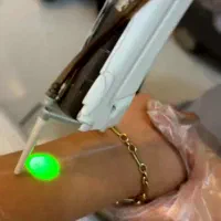 لیزر تضمینی دکا دربروجرد