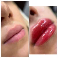 شیدینگ تخصصی لب ( ساکورالیپس )|خدمات آرایشگری و زیبایی|قم, بلوار امین و ساحلی|دیوار