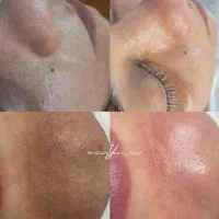 فیشال و پاکسازی